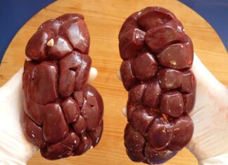 Ile kosztuje nerka w Iranie? Ile kosztuje nerka w Iranie?