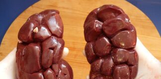 Ile kosztuje nerka 2023?